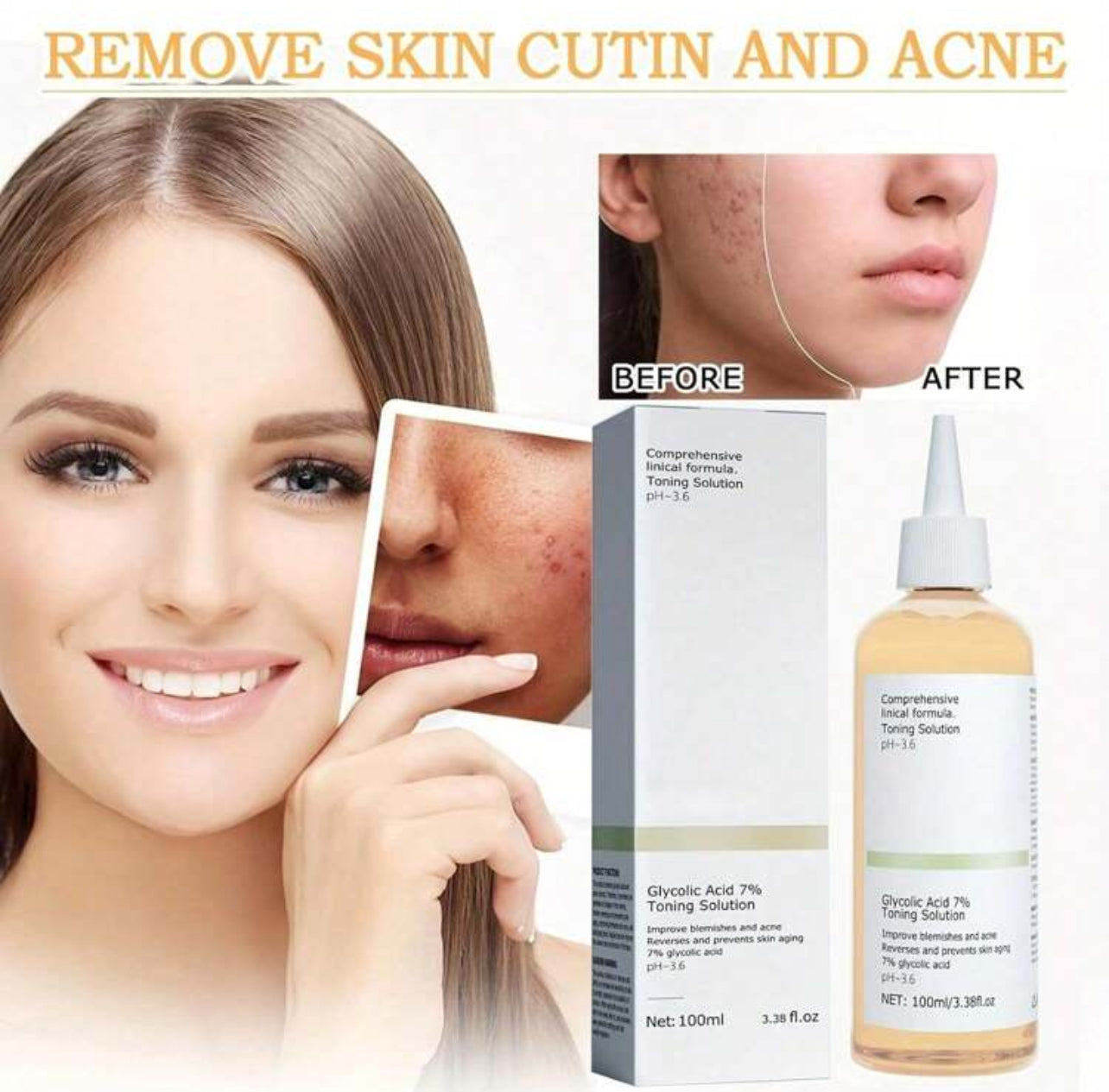 Glycolic Acid 7% Toner, Glycolic Sour 7% Toning, Glycolic Acid 7%, Facial Exfoliation Astringe Pores (100 Ml)